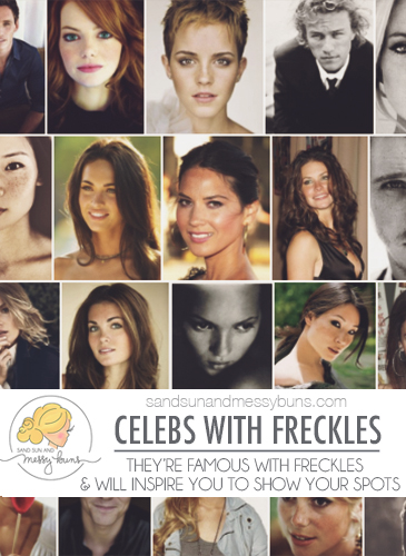 Celebrities with Freckles: These beautiful celebs will inspire you to show your spots