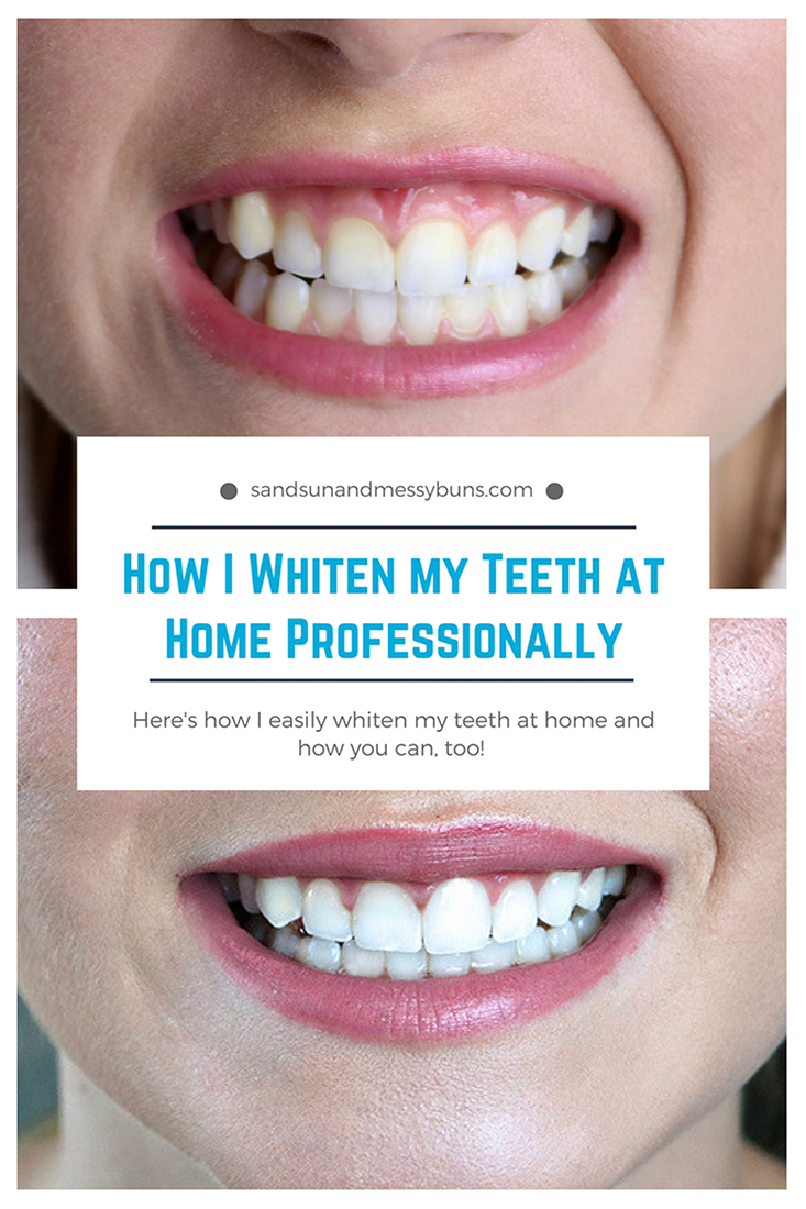 How to whiten your teeth at home and get professional results at a great price! #ad #smilebrilliant