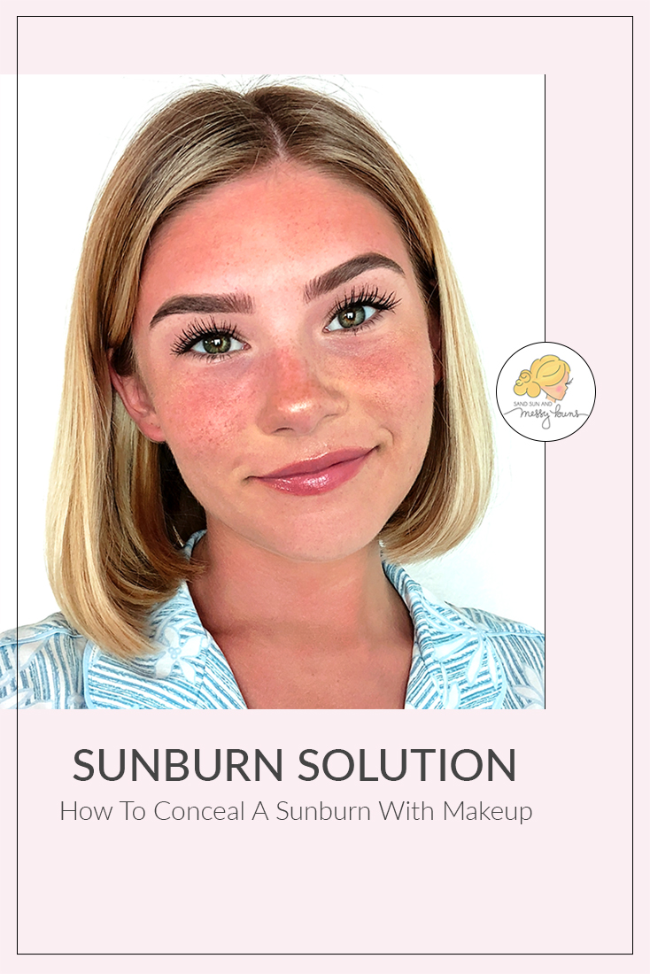 can you put makeup on a sunburn 2